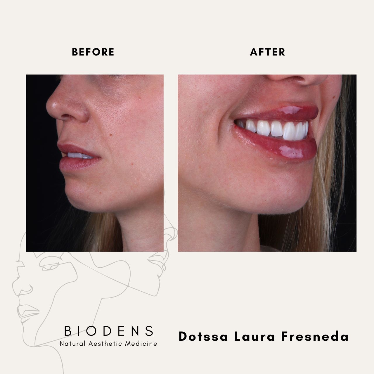 Laura Fresneda Bustos-17