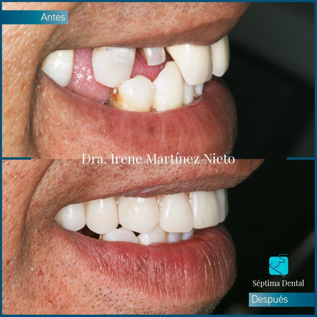 Irene Martinez Nieto-7