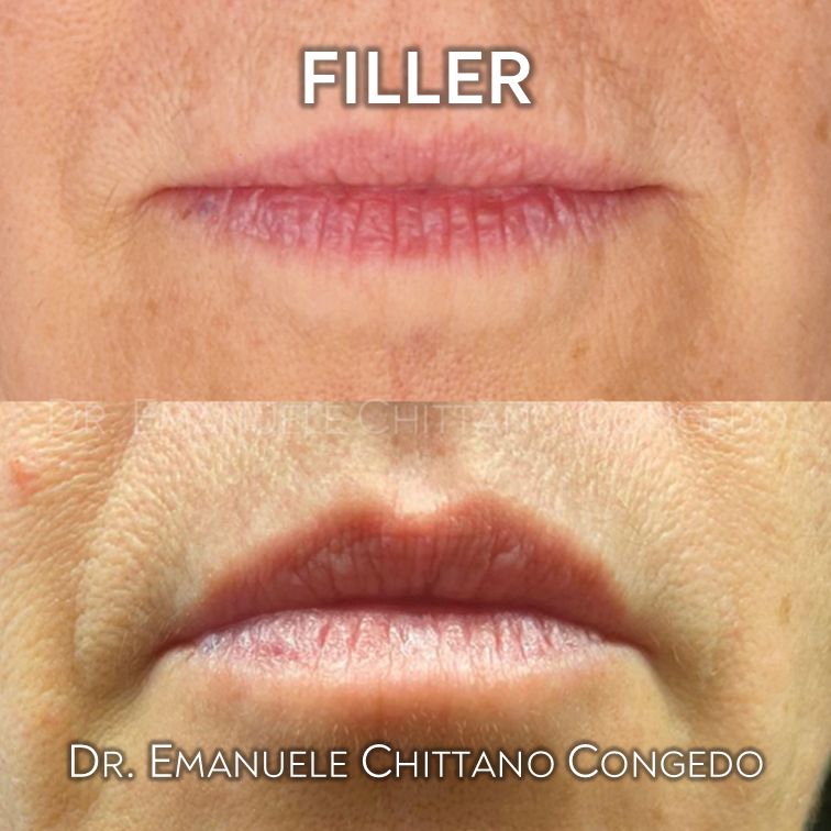 Emanuele Chittano Congedo-13