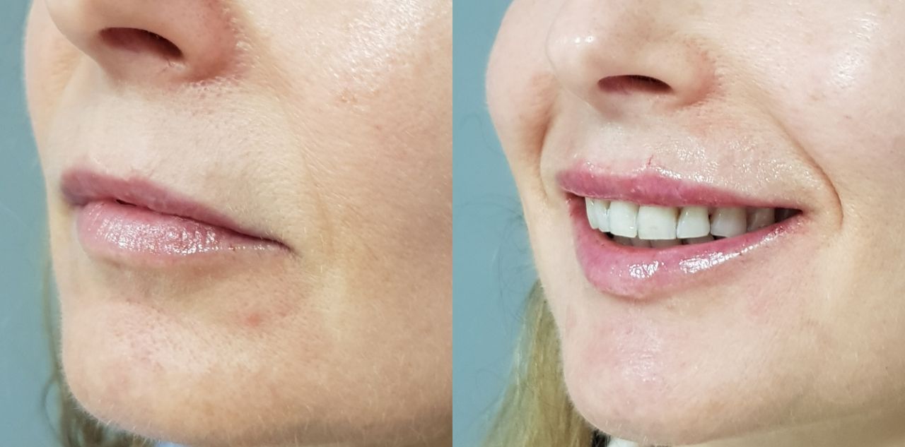 Rosalba Herrero Zerpa-484