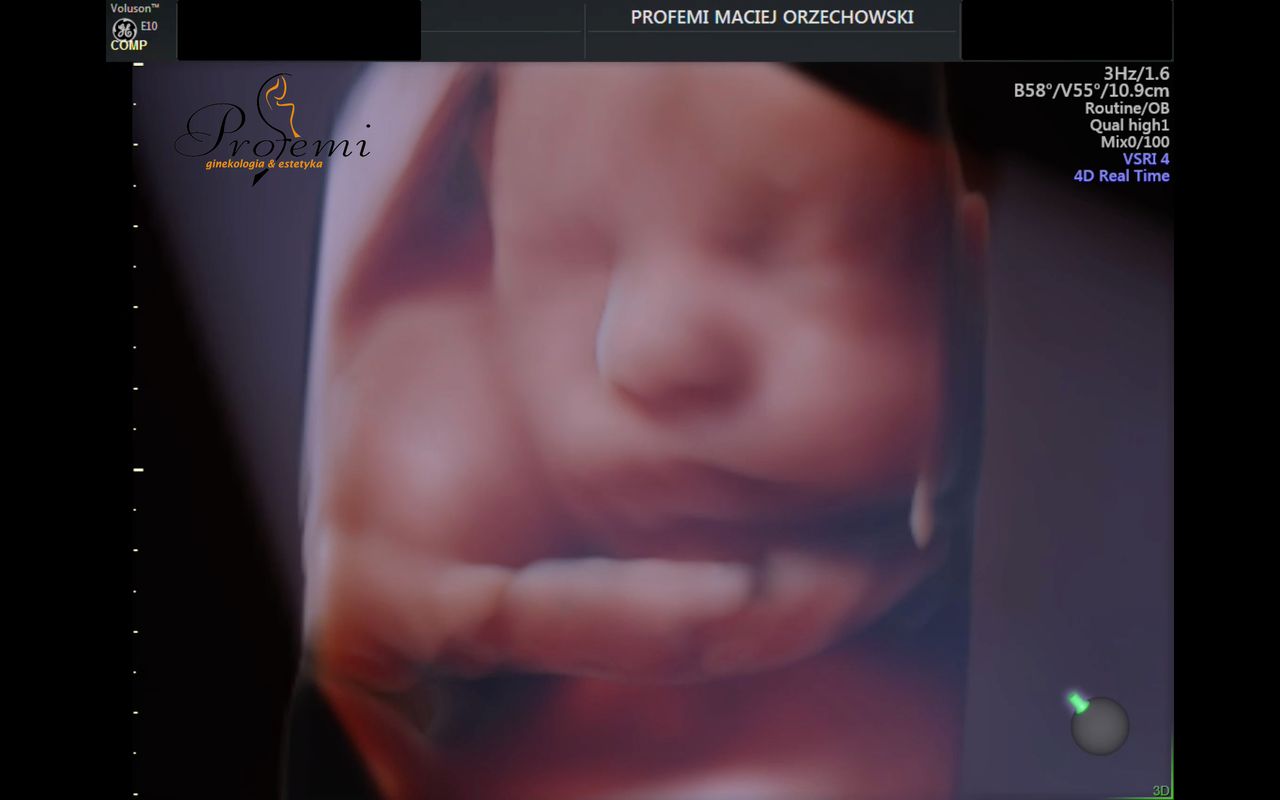 Maciej Orzechowski-26