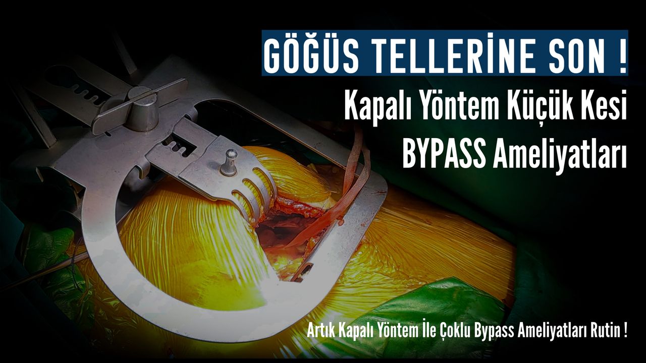 Tayfun Aybek-0