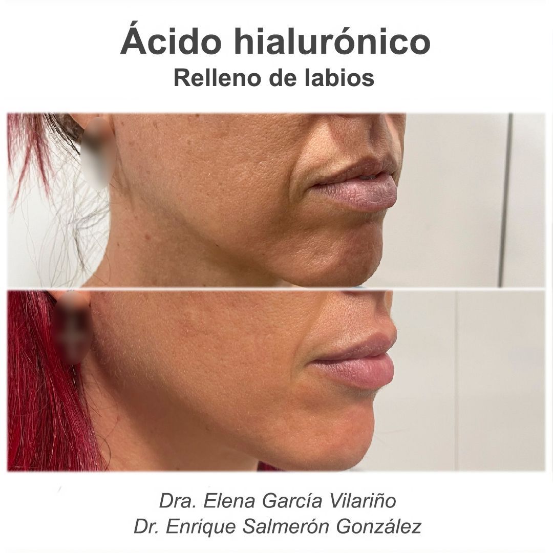 Enrique Salmerón González-76