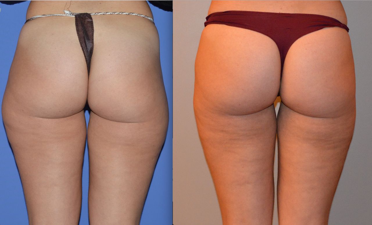 Michele Antonacci-12