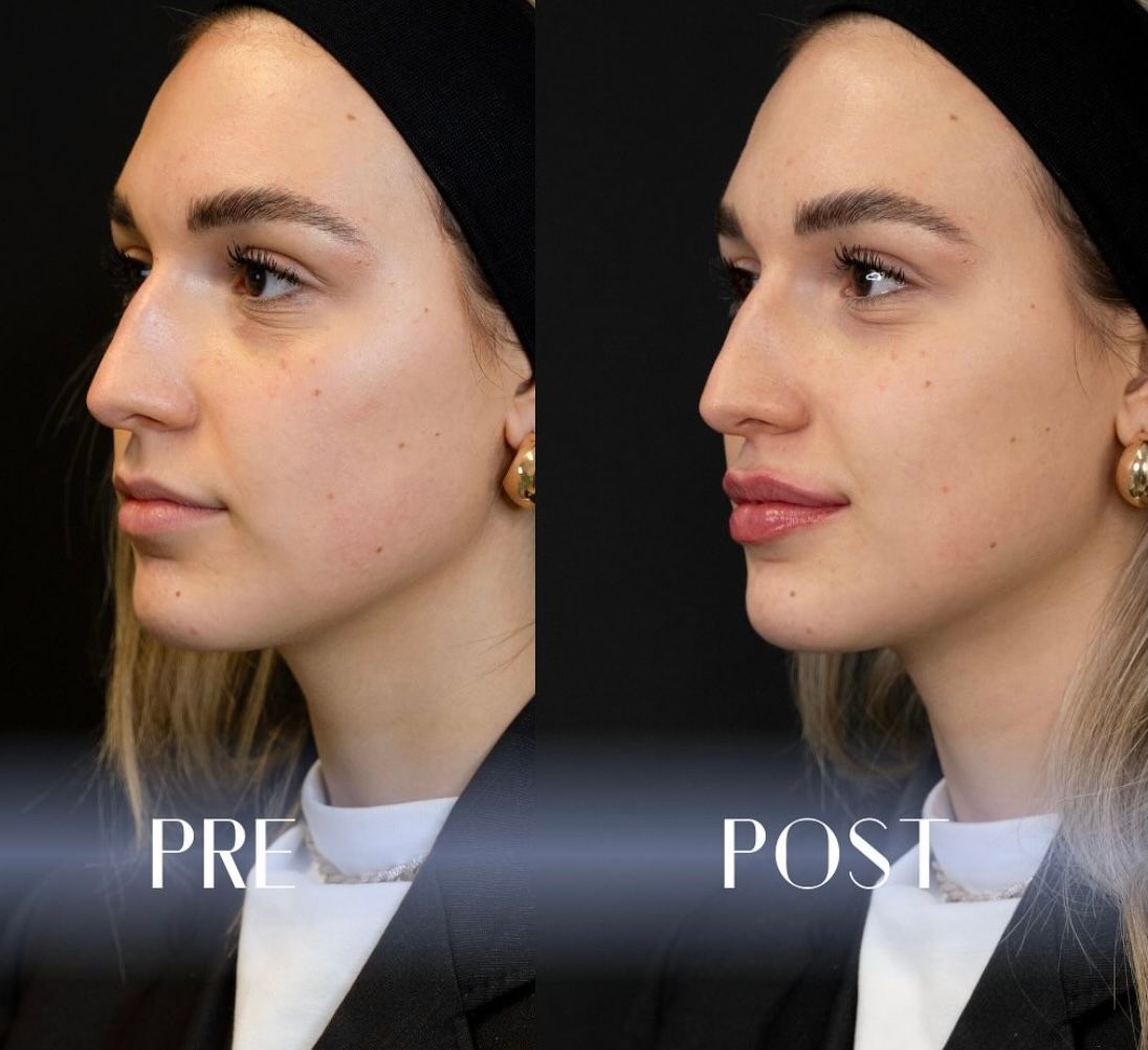 Marco Rizzetto Stubel-7