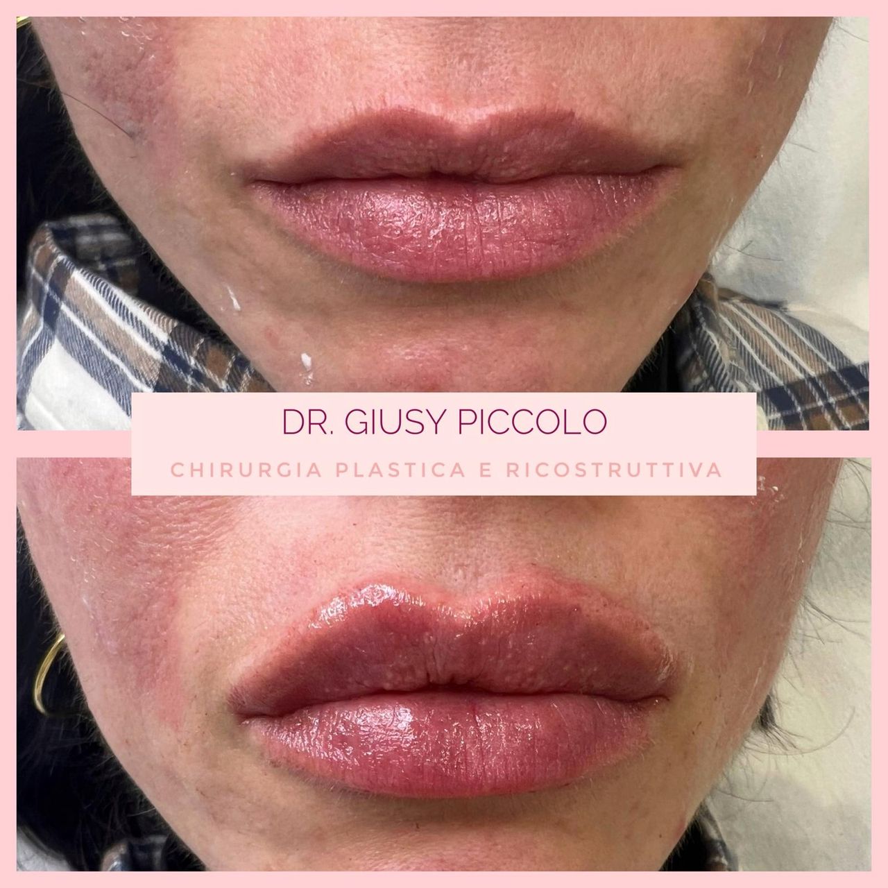 Giuseppina Piccolo-3