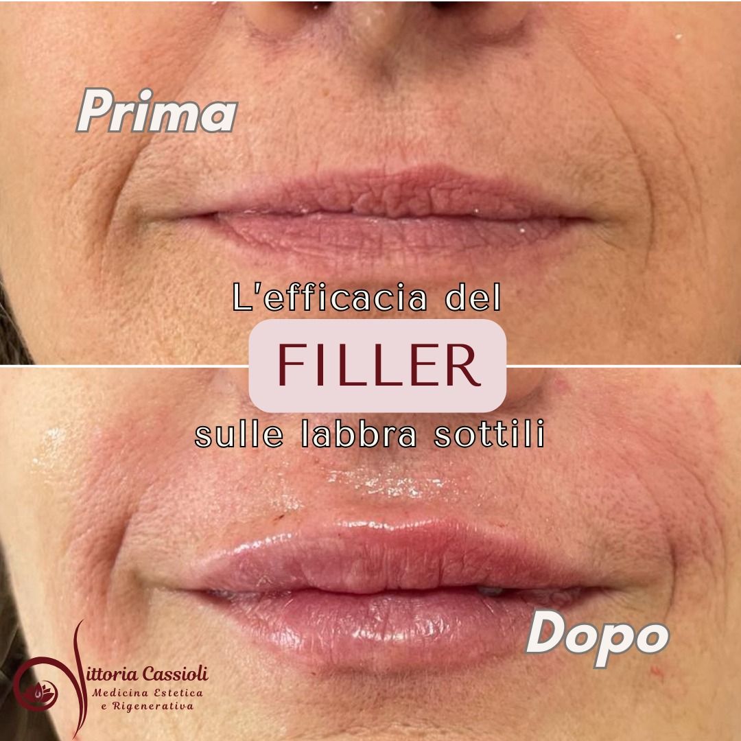 Vittoria Cassioli-36