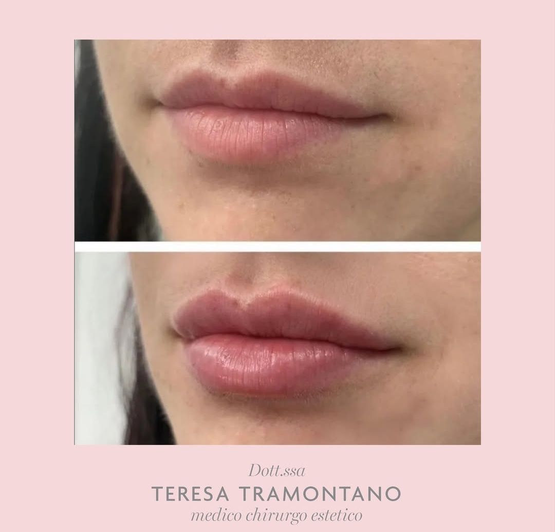 Teresa Tramontano-5
