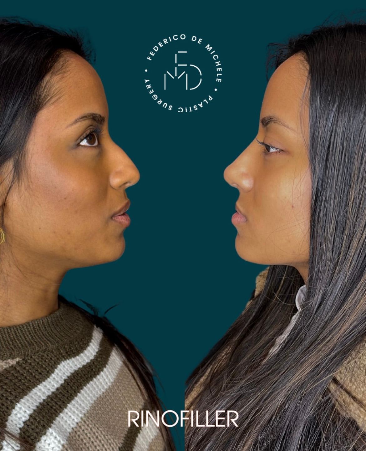 Federico De Michele-5