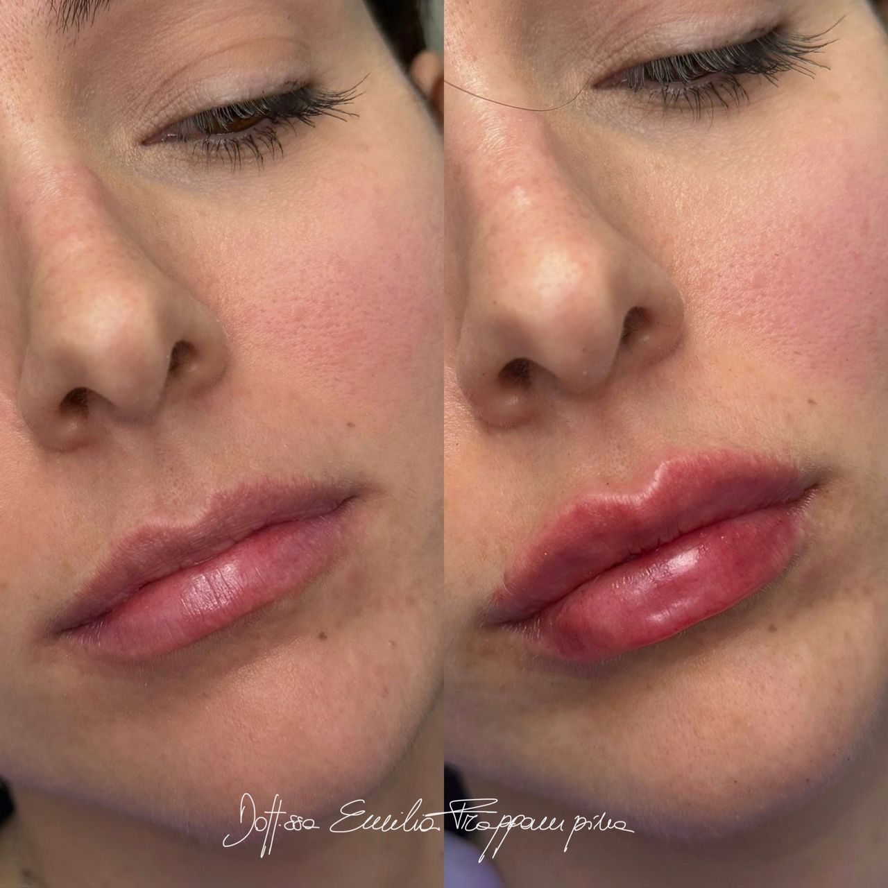 Emilia Frappampina-9