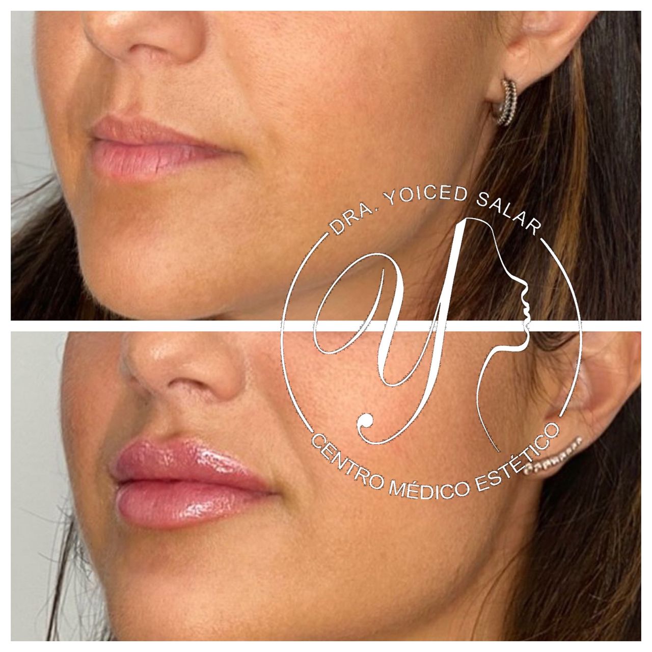 Yoiced Salar Peñate-18