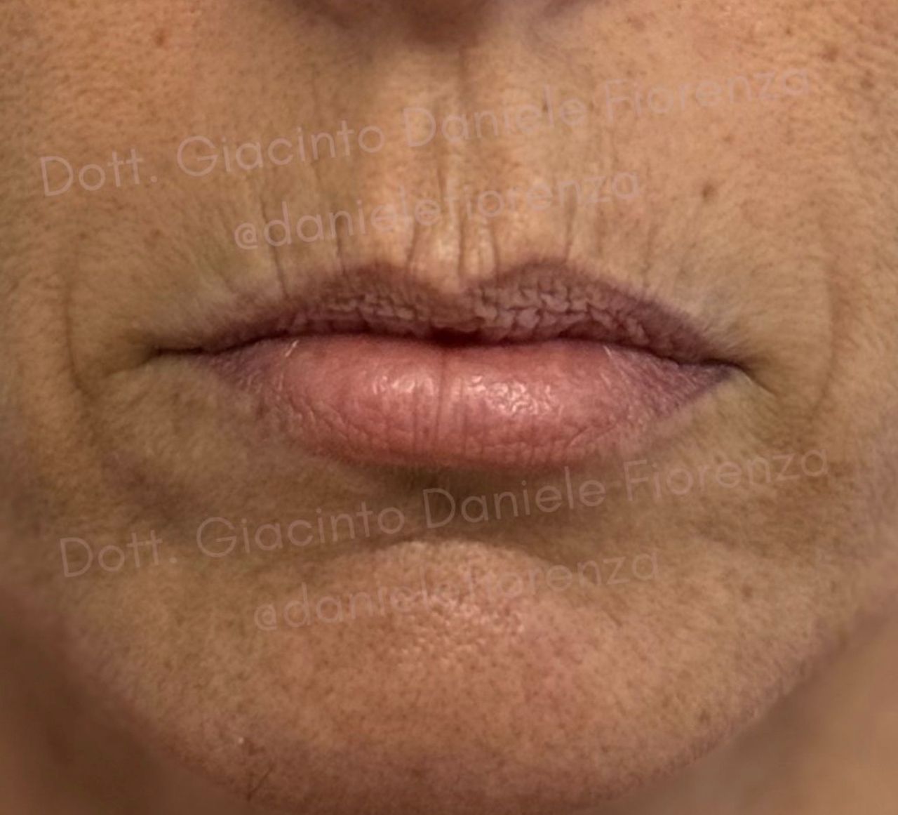 Giacinto Daniele Fiorenza-1