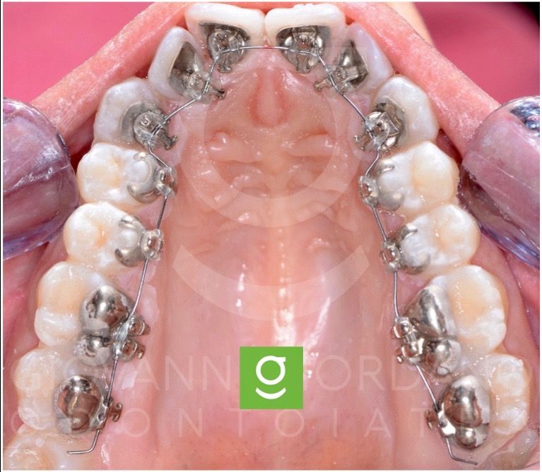 Giovanni Giordano-13