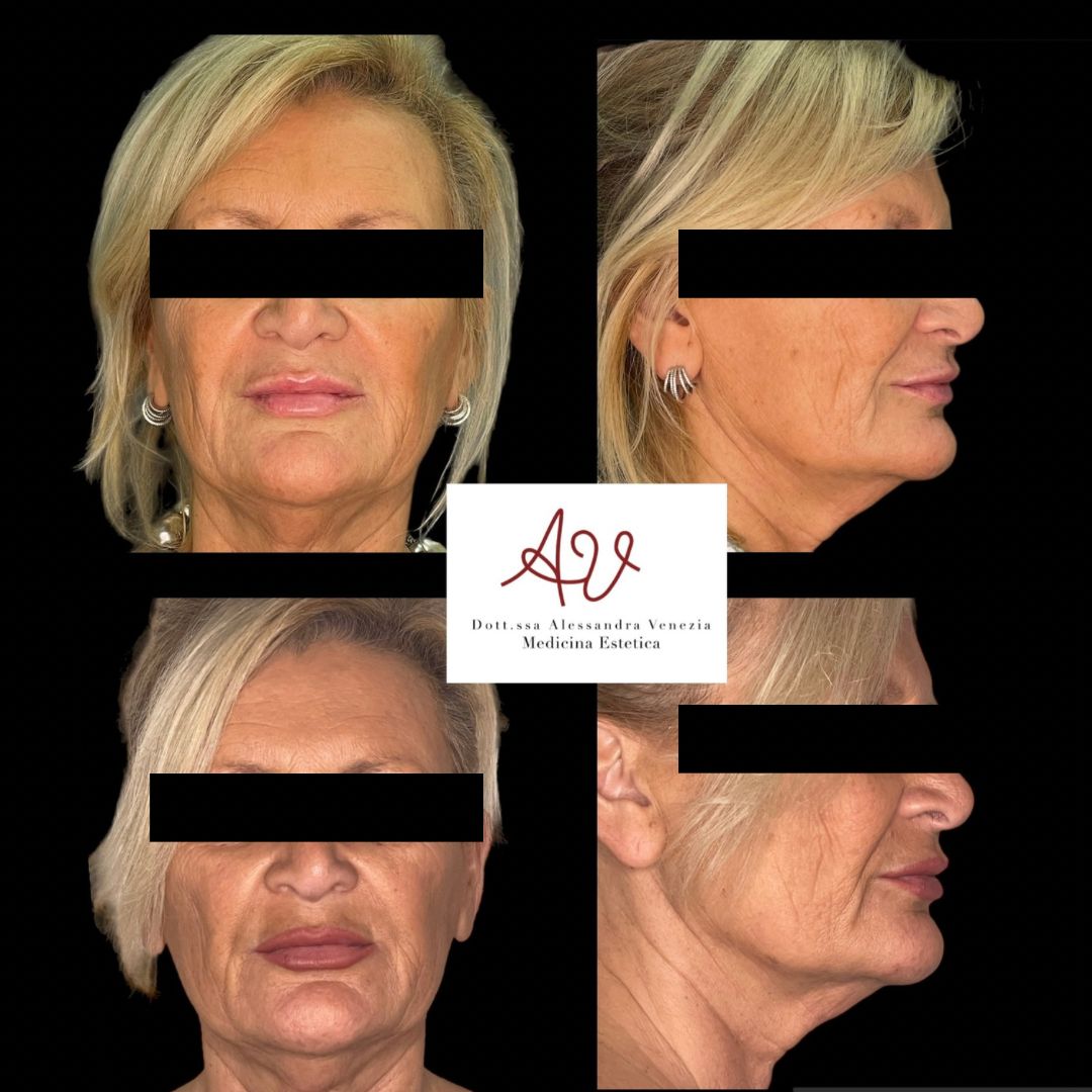 Alessandra Venezia-19