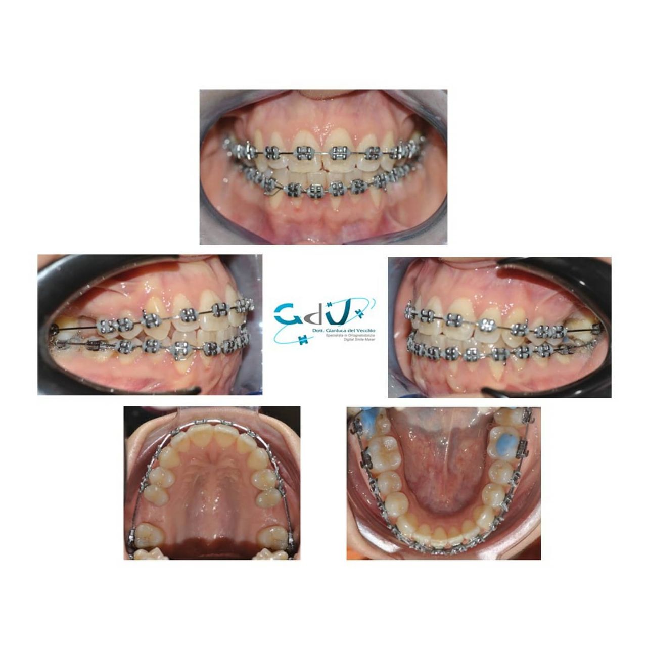 Gianluca Del Vecchio-101