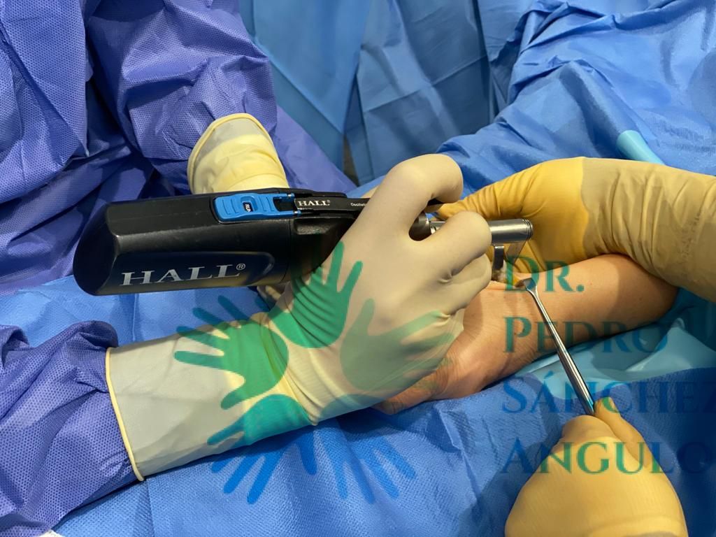 Pedro Sánchez Angulo-8