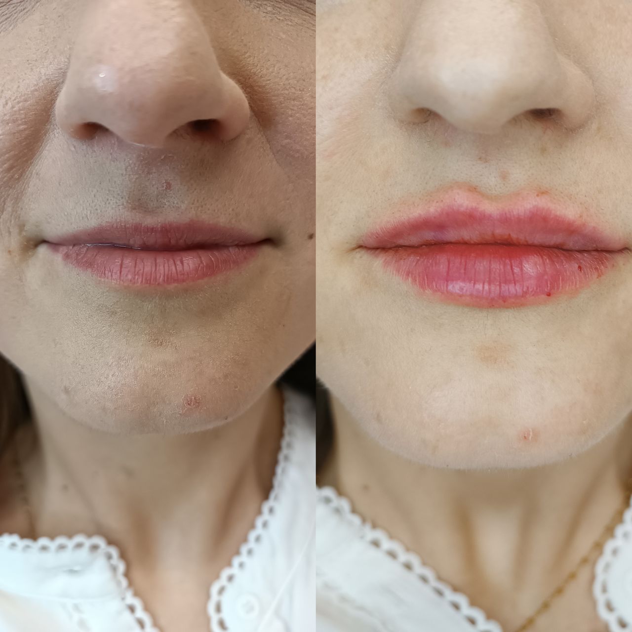 Michalina Zagańczyk-Bączek-14