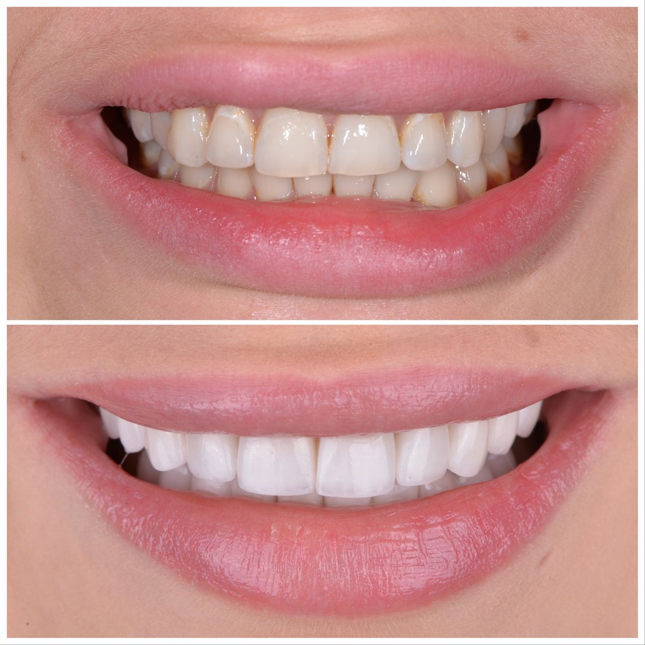 Martin Bartoszcze-38