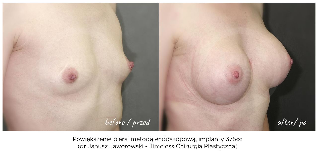 Janusz Jaworowski-154