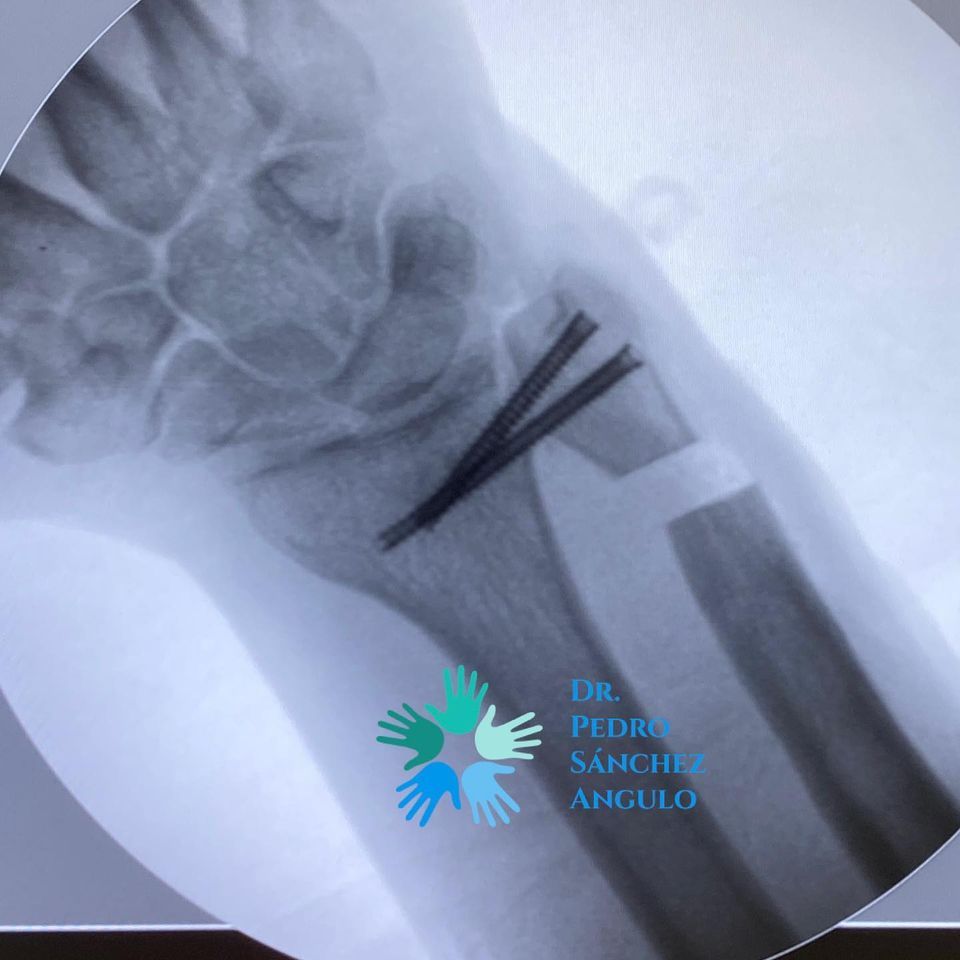 Pedro Sánchez Angulo-12