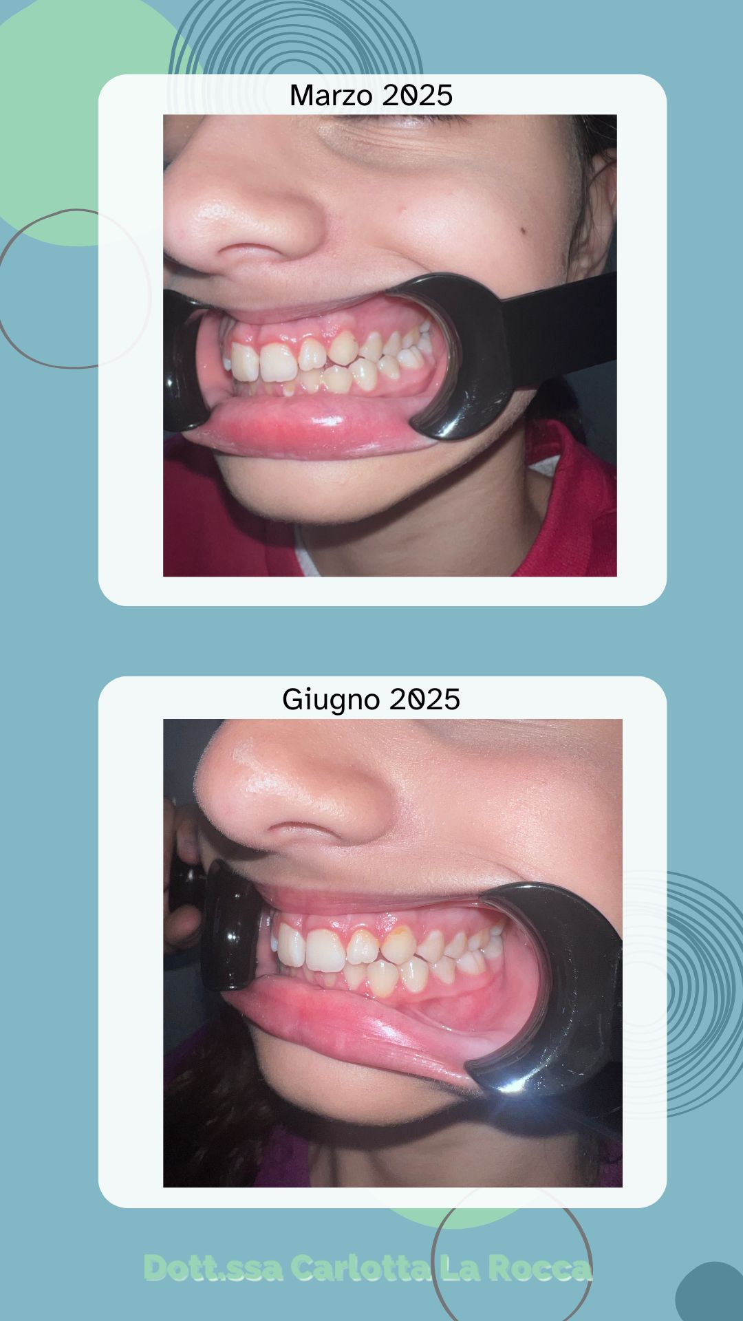 Carlotta La Rocca-11