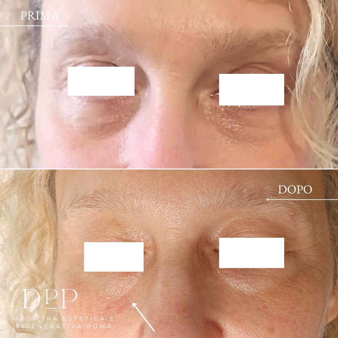 Davide Prosperi Porta-4