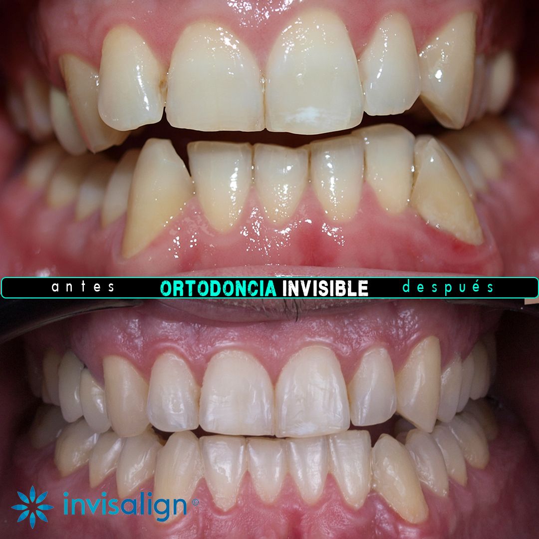 Juan Carlos Sánchez Pérez-1