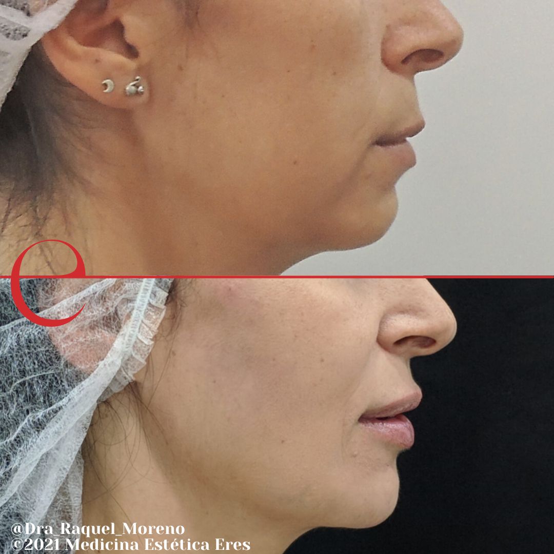 Raquel Moreno Pentinel-83