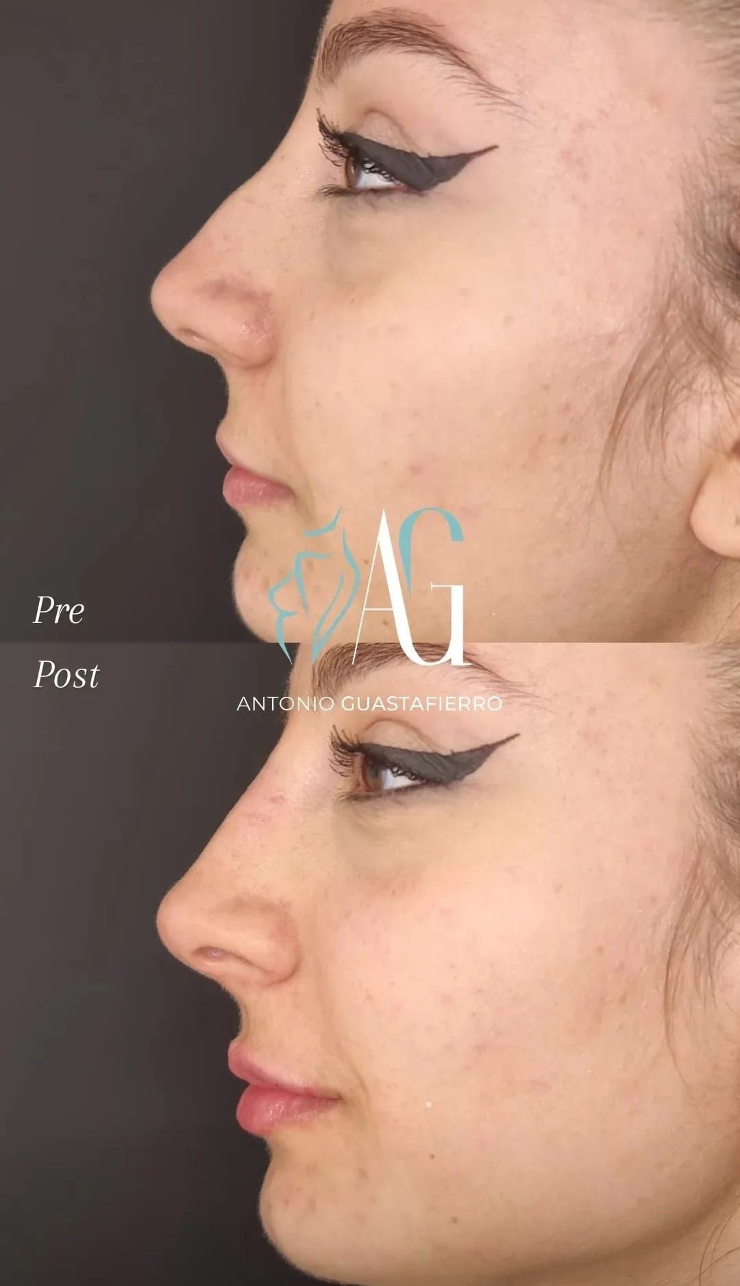 Antonio Guastafierro-5