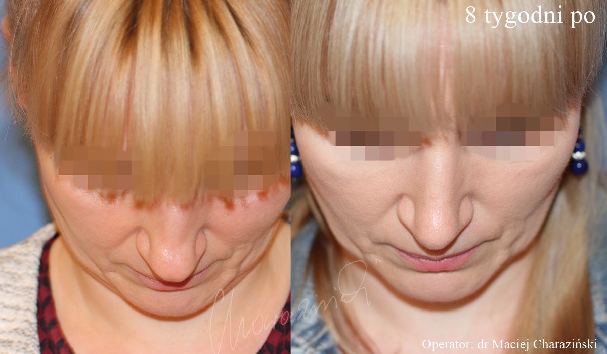 Maciej Charaziński-31