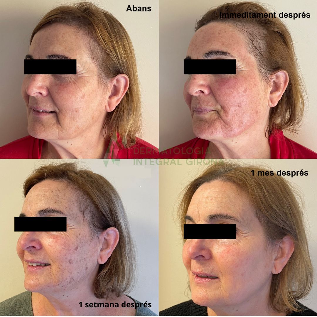 Maria Damont Serra-2