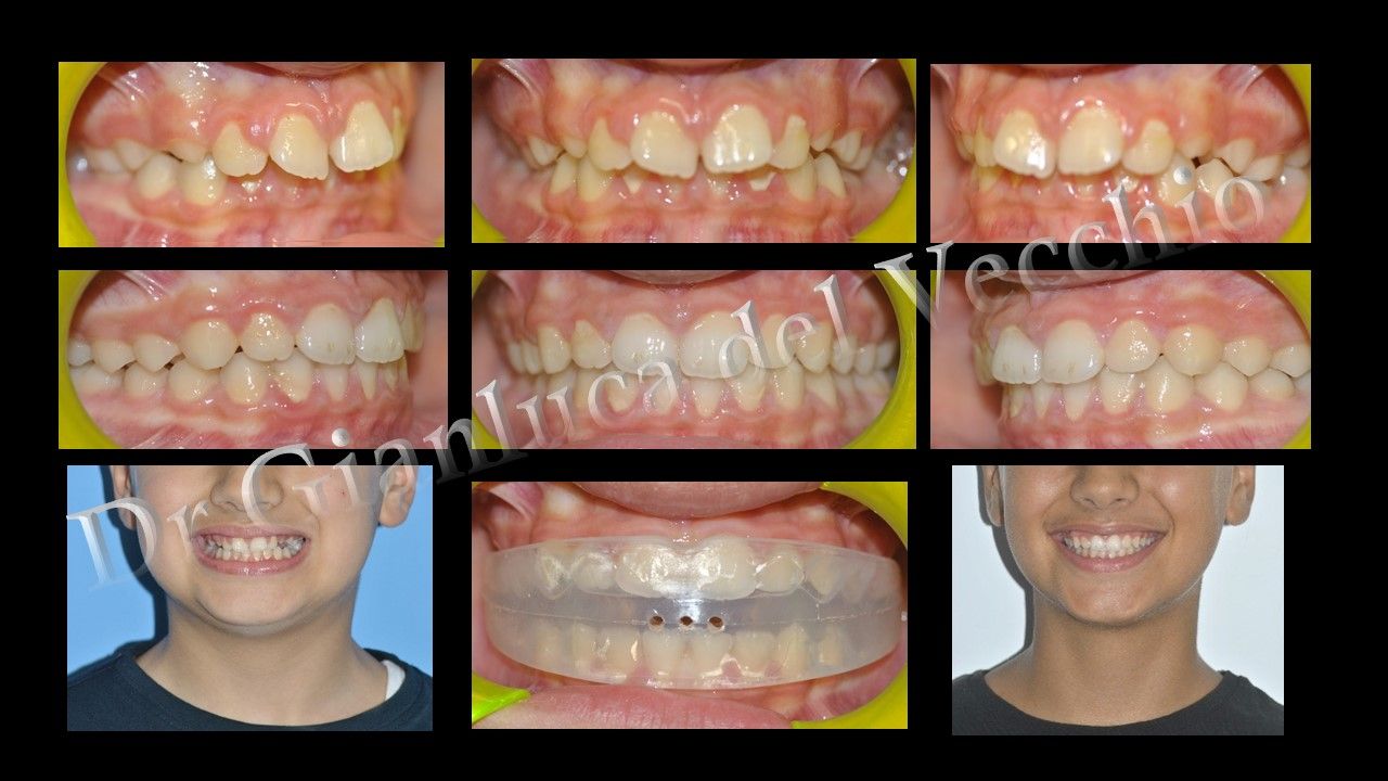 Gianluca Del Vecchio-11