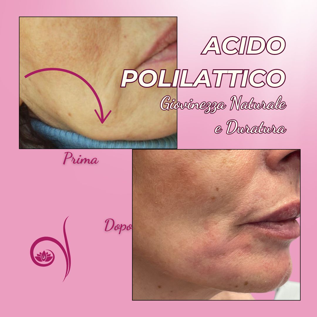 Vittoria Cassioli-11