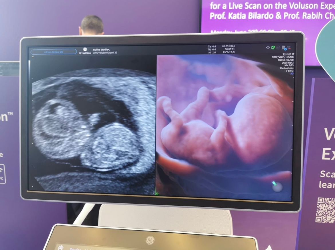 Wioletta Rozmus-Warcholińska-197