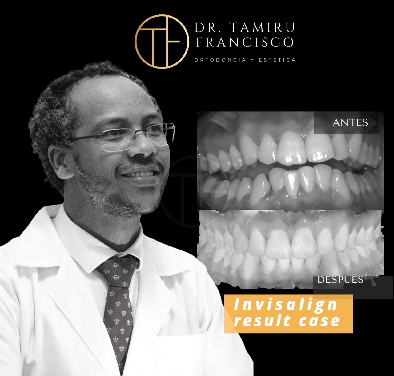 Tamiru Francisco Aduna-0