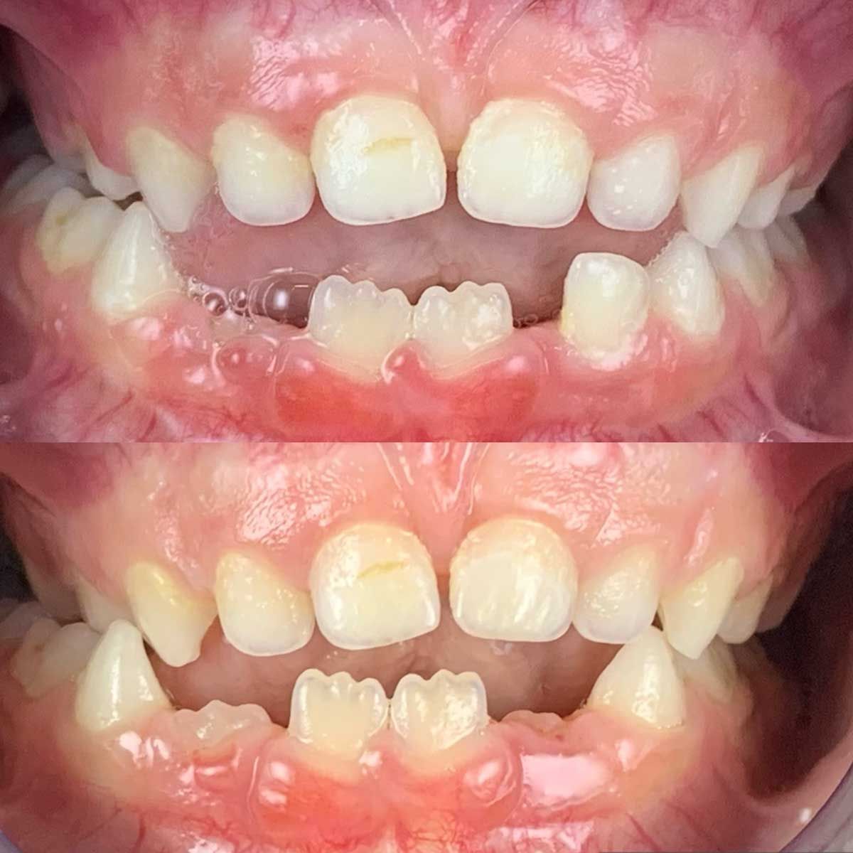 Gianluigi Bittante-18