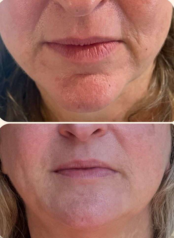 Magdalena Kawecka-14