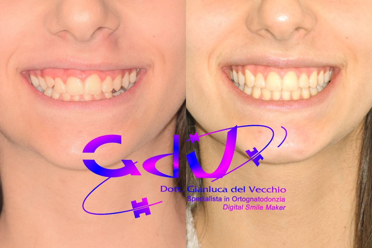 Gianluca Del Vecchio-177