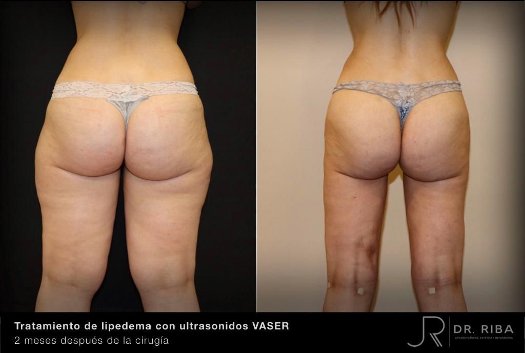 Jordi Riba Vilchez-22