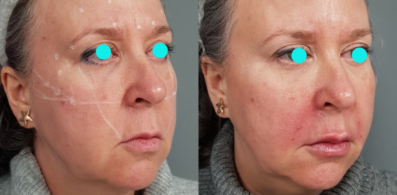 Rosalba Herrero Zerpa-121