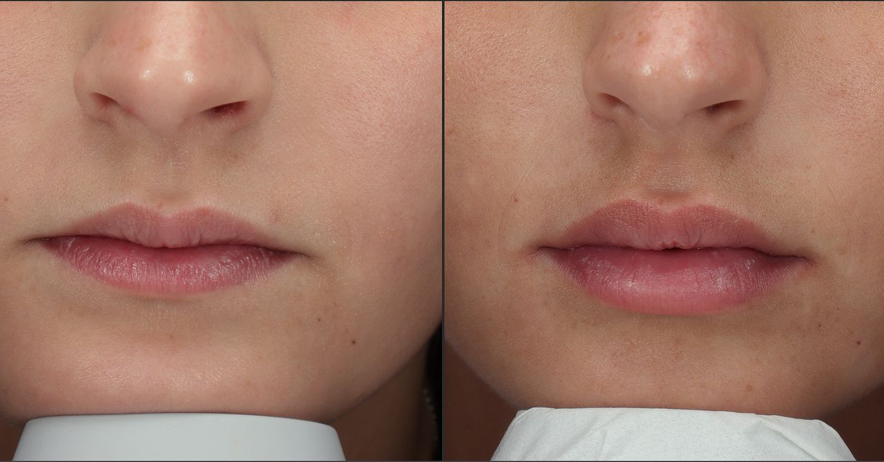 Giordano Vespasiani-58