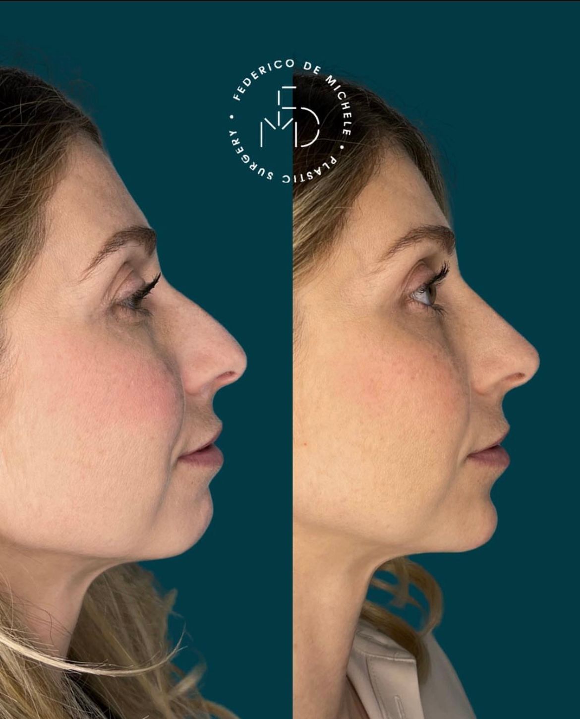 Federico De Michele-2