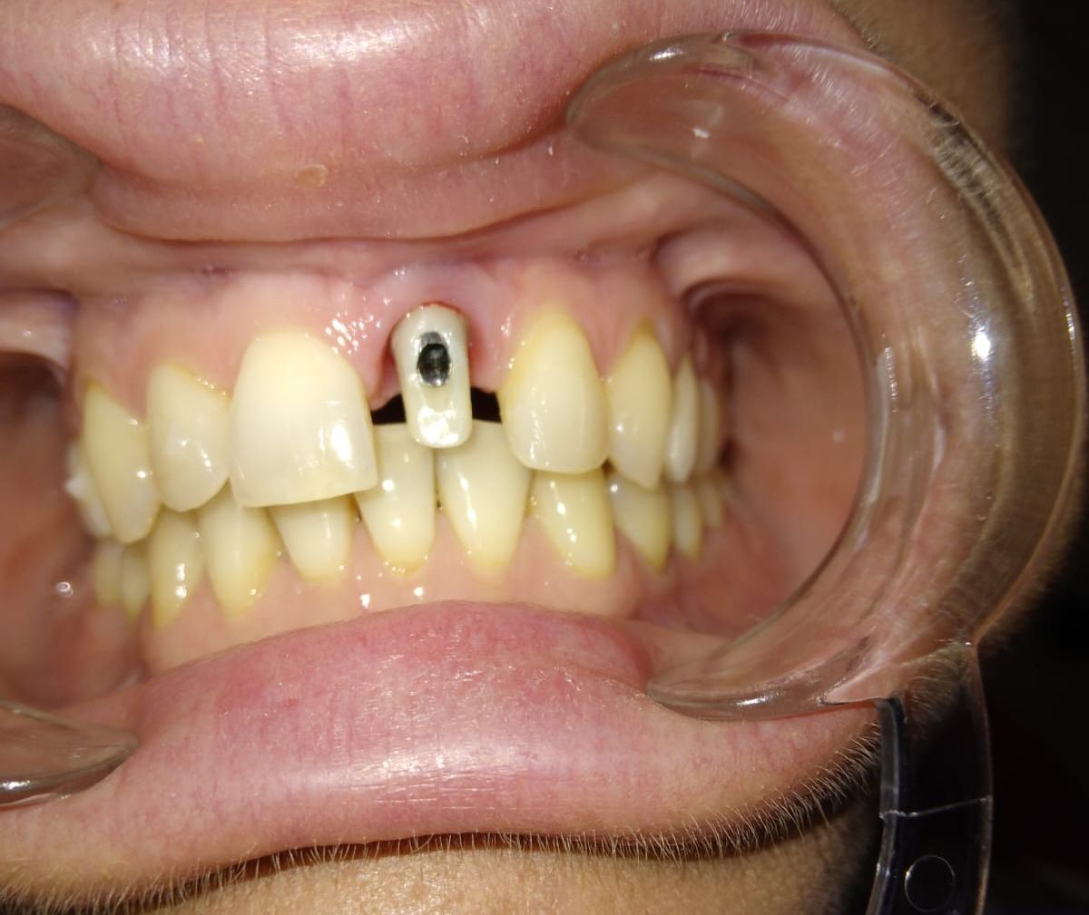 Luigi Aiardo Esposito-17