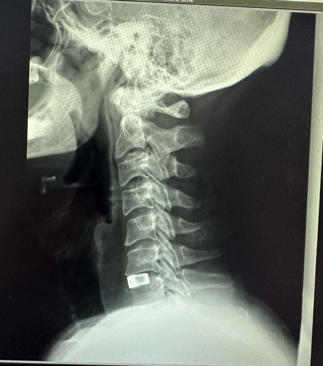 Valerio Cipolloni-21