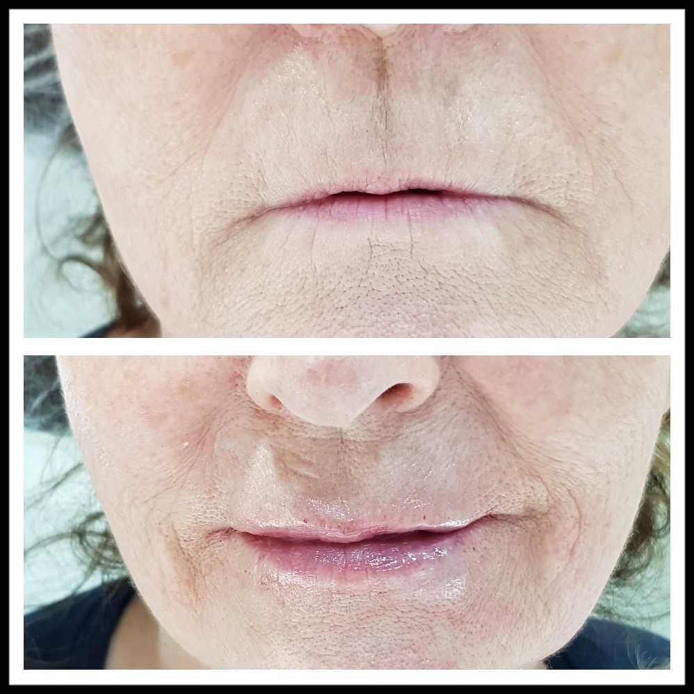 Rosalba Herrero Zerpa-296