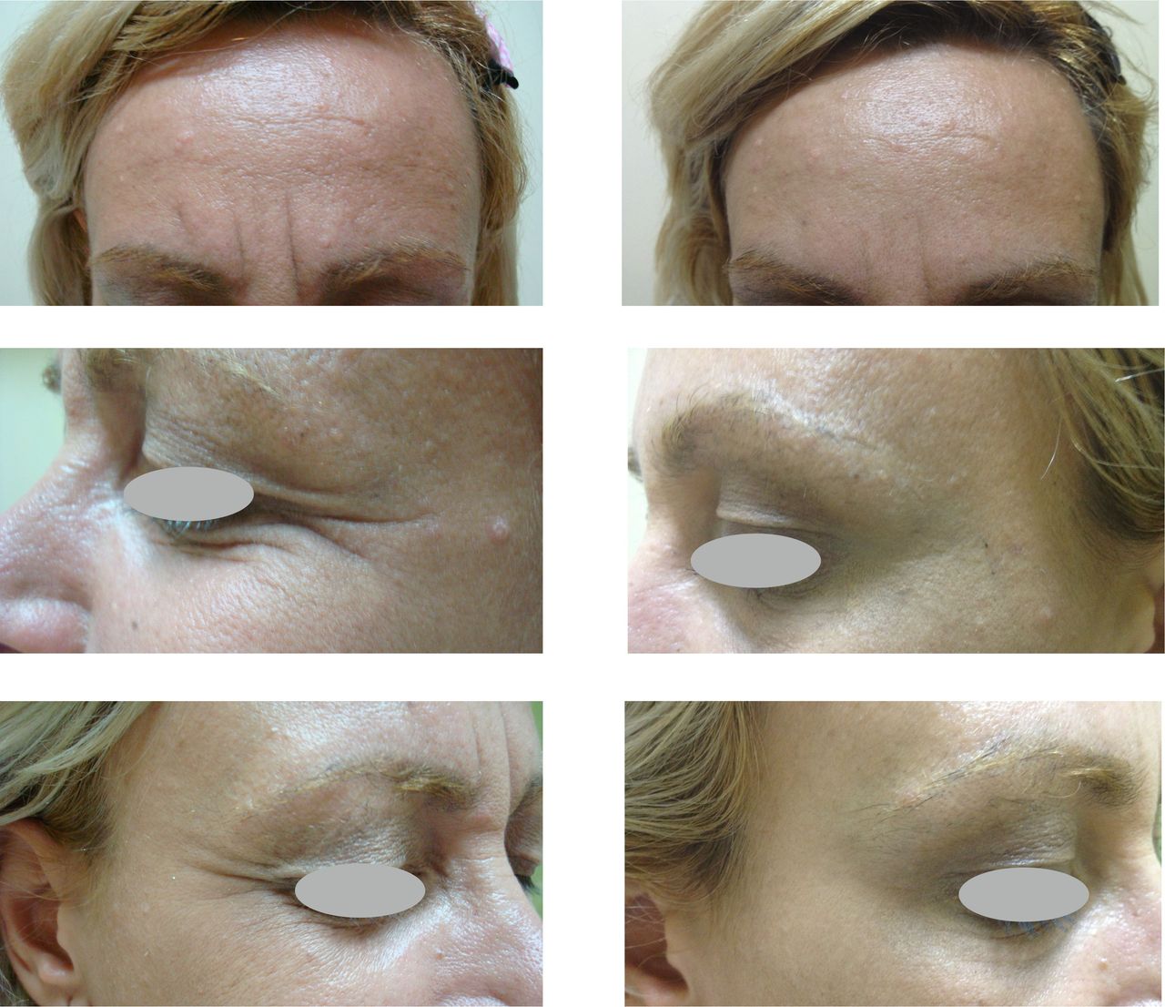 Virginia Cristina Rapisarda-30