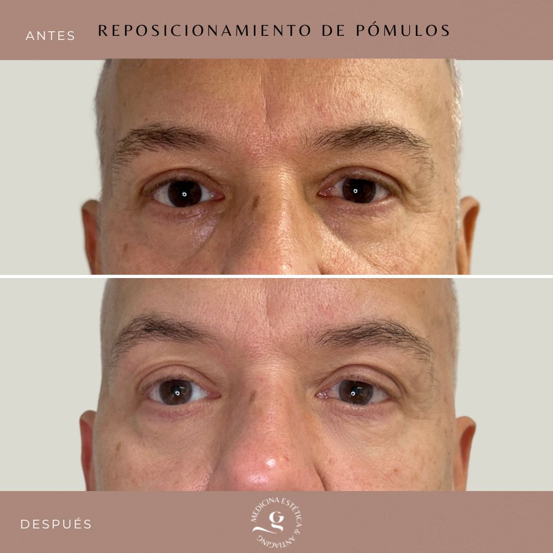 ​Giovanni Giorgianni-15