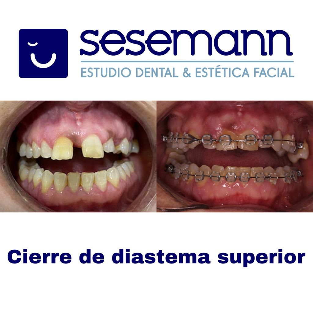 Paula Cano Carrillo-117