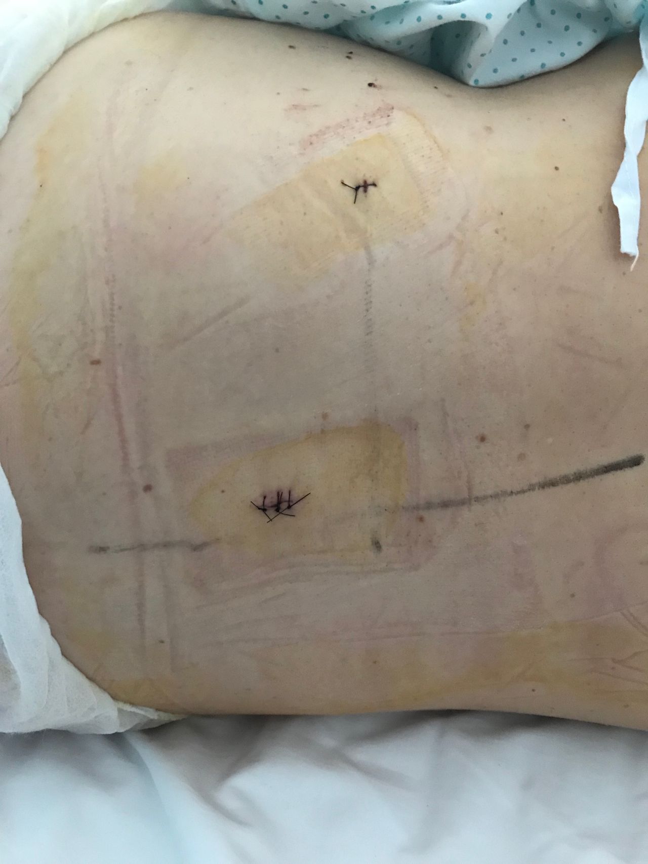 Juan Camilo Hernandez Acevedo-39