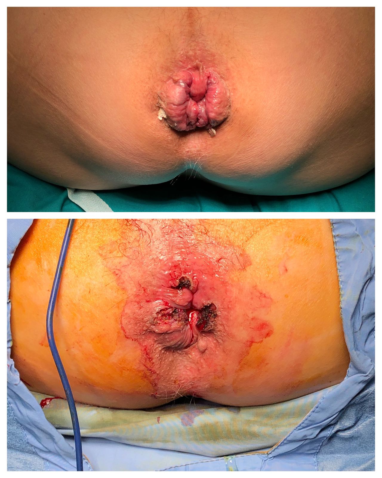 Antonio Ferronetti-6